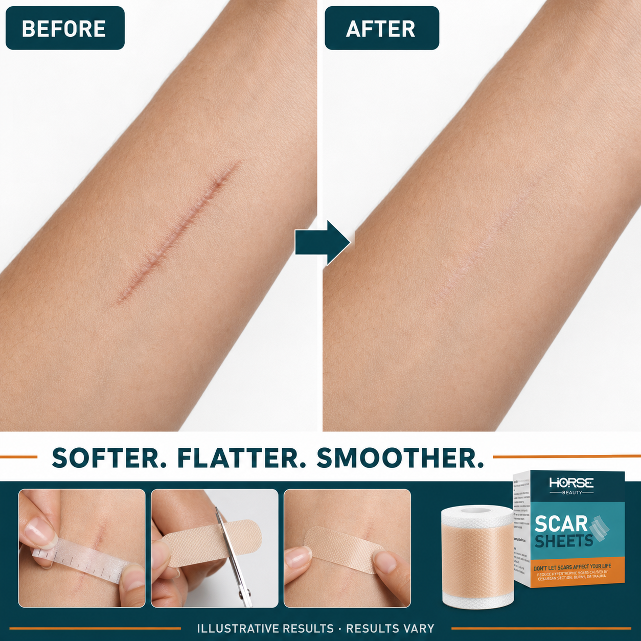Forearm scar before and after with application steps