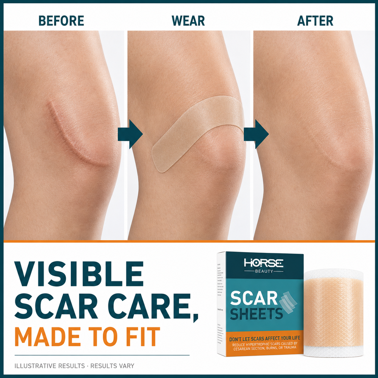 Knee scar before, wear and after comparison