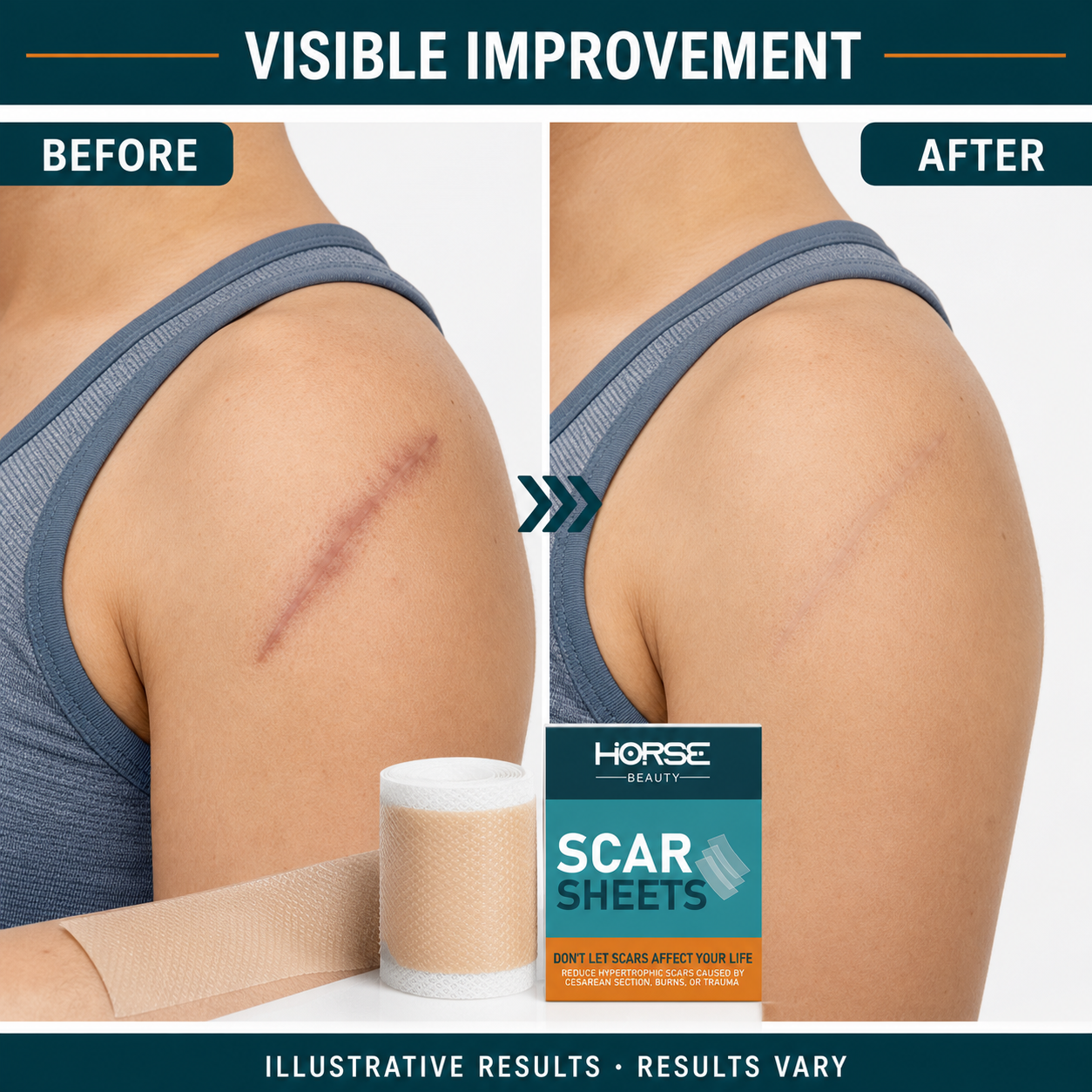 Shoulder scar before and after advertising concept