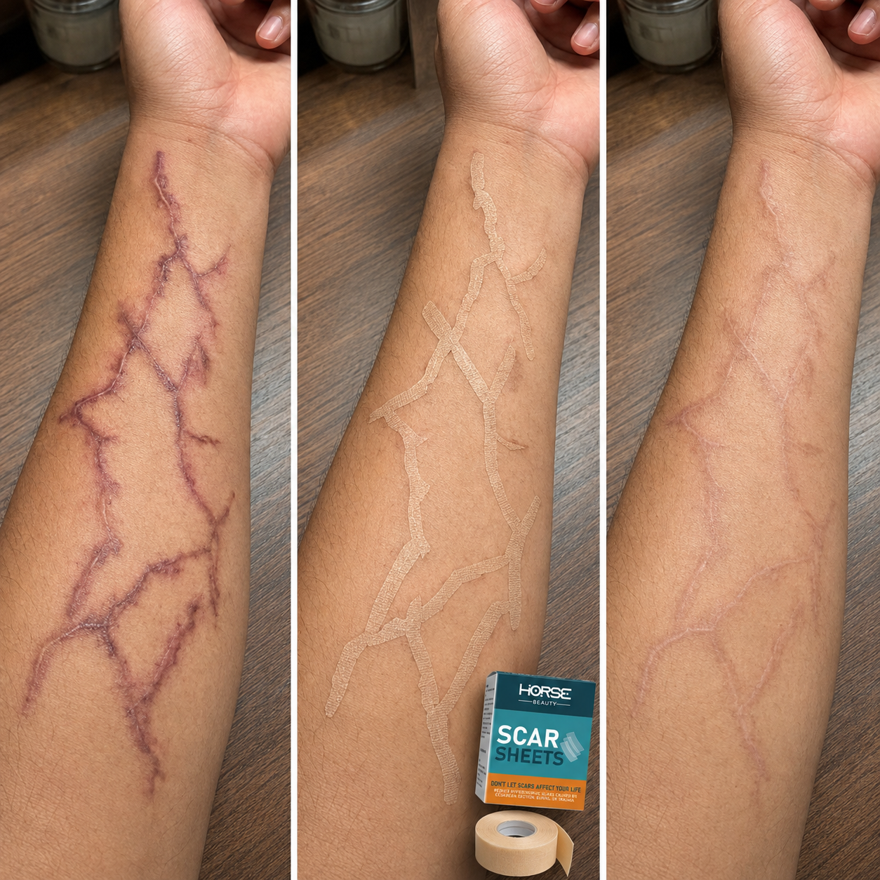 Forearm comparison showing multiple healed scratch scar tracks