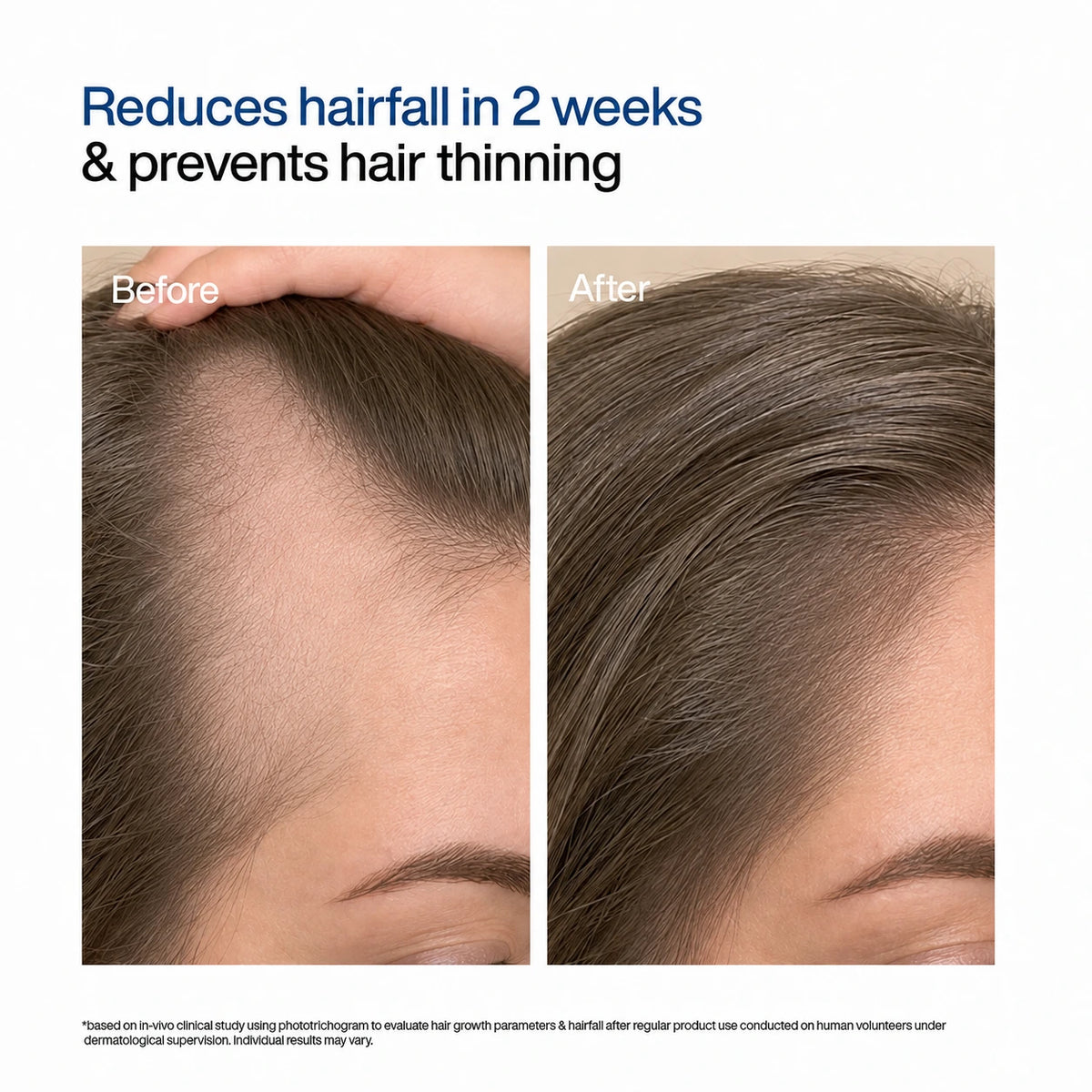 Kelveth Hair, Beard & Body Growth Serum Roll-On — 30 mL