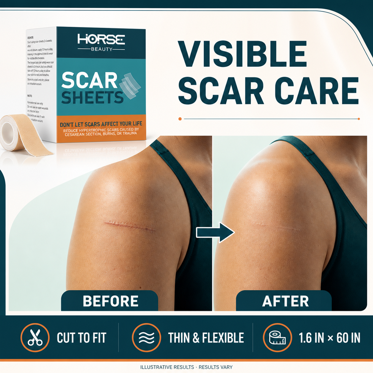 Scar sheets product with illustrative shoulder scar comparison